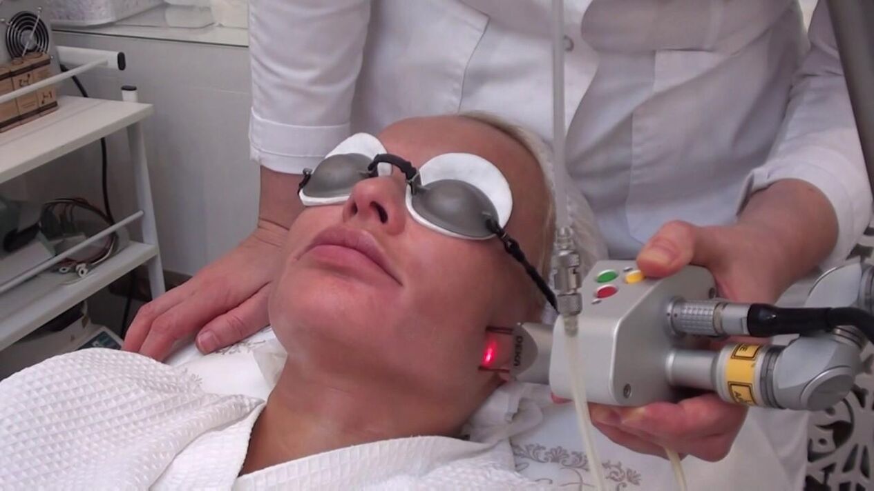 Treatment with a laser beam on problematic facial skin areas